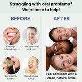 Gum Health Tooth Powder for Sensitive Teeth – Fluoride-Free with Ginseng & Herbs
